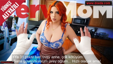Tombul Üvey Annes Elleri Kırık Delikanlıya 31 Çektirmek İçin Anlaştı